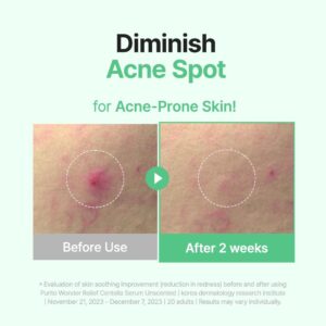 PURITO Centella Unscented Serum, Korean Centella, for All Skin Types, Ampoule, Soothing, Calming, Facial Serum for face, Vegan & Cruelty-Free, Korean Skin Care, 60ml 2fl.oz - Image 4